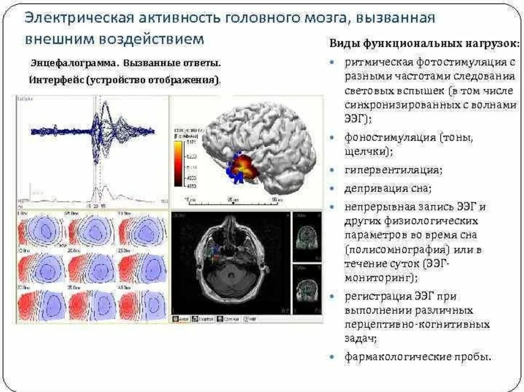 Электрическая активность головного мозга. Биоэлектрическая активность головного мозга. Виды электрической активности головного мозга. Активность мозговой деятельности.