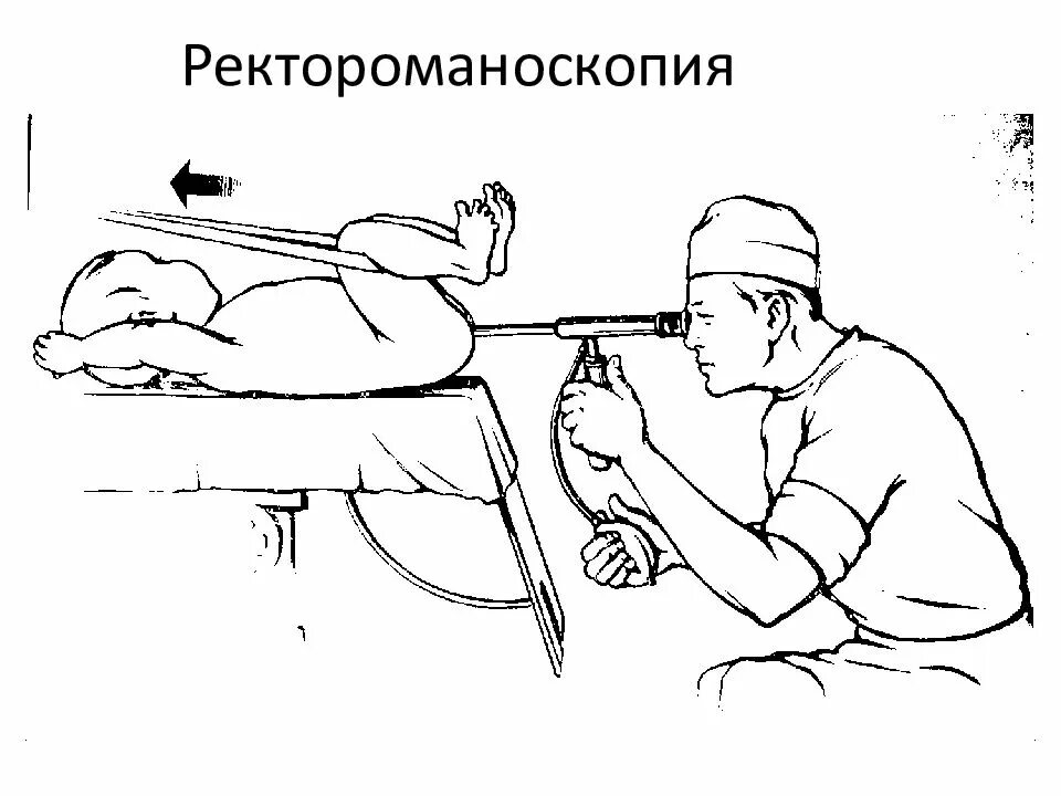 Подготовка пациента к ректороманоскопии колоноскопии. Ректороманоскопия – исследование прямой и сигмовидной кишки.. Ректороманоскопия прямой кишки. Обследование кишечника ректороманоскопия. Ректороманоскопия это исследование.