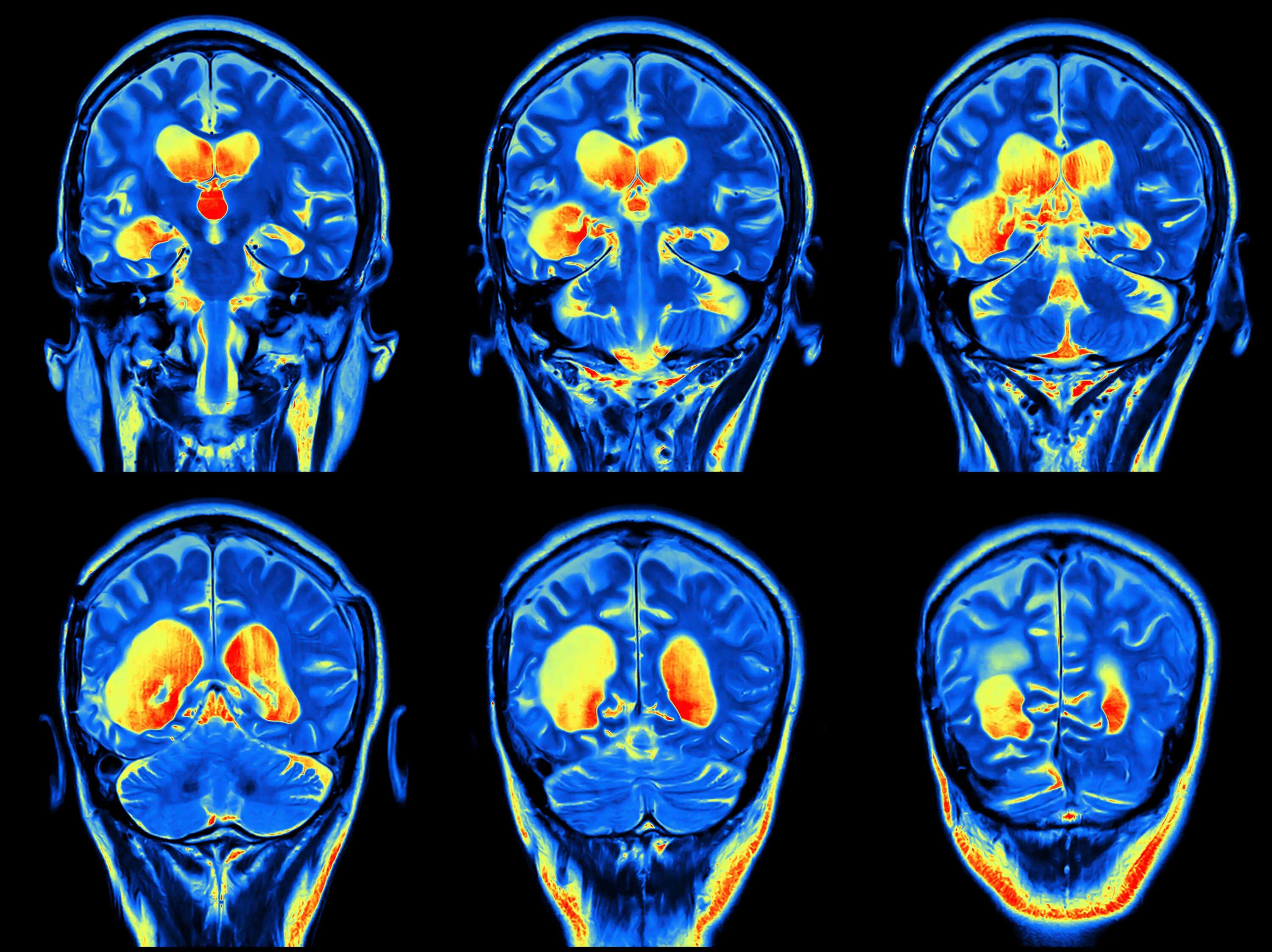 Снимки головного мозга. Томография головного мозга. Мрт головного мозга с контрастом. Кт головного мозга с контрастом.