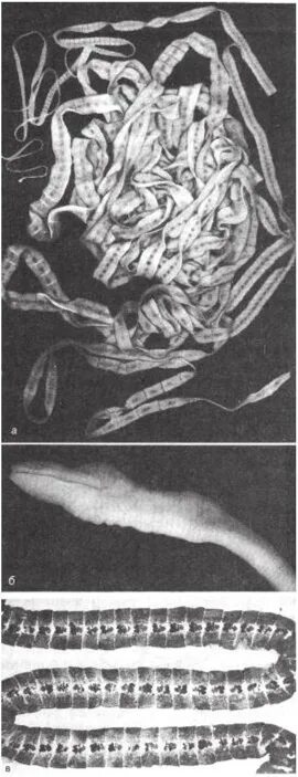 Личинки лентеца. Ленточные черви широкий лентец. Ленточный червь лентец. 41. Ленточные черви – широкий лентец..