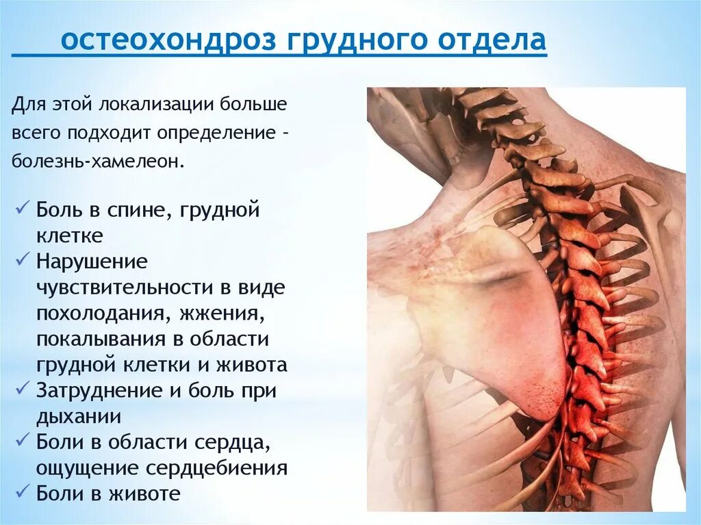 Боль в спине трудно дышать. Остеохондроз грудного отдела позвоночника симптомы. Остеохондроз th5-th8. Остеохондрома грудного отдела позвоночника. Грудной остеохондроз симптомы.