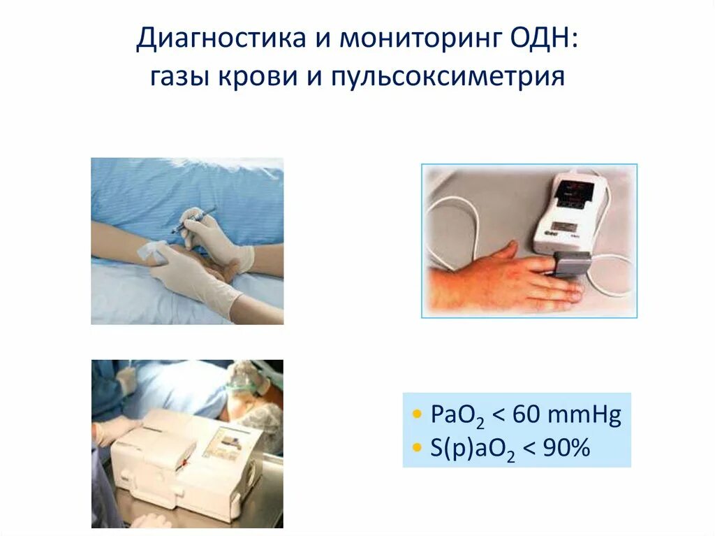 Пульсоксиметрия алгоритм выполнения. Алгоритм пульсоксиметрии. пульсоксиметрия подготовка. пульсоксиметрия подготовка пациента. алгоритм измерение пульсоксиметрия.