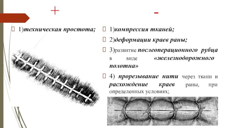 Расхождение краев раны. Хирургические швы презентация. Как называется шов после операции