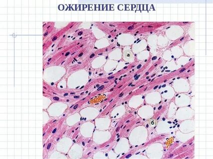 Соединительная ткань сердца