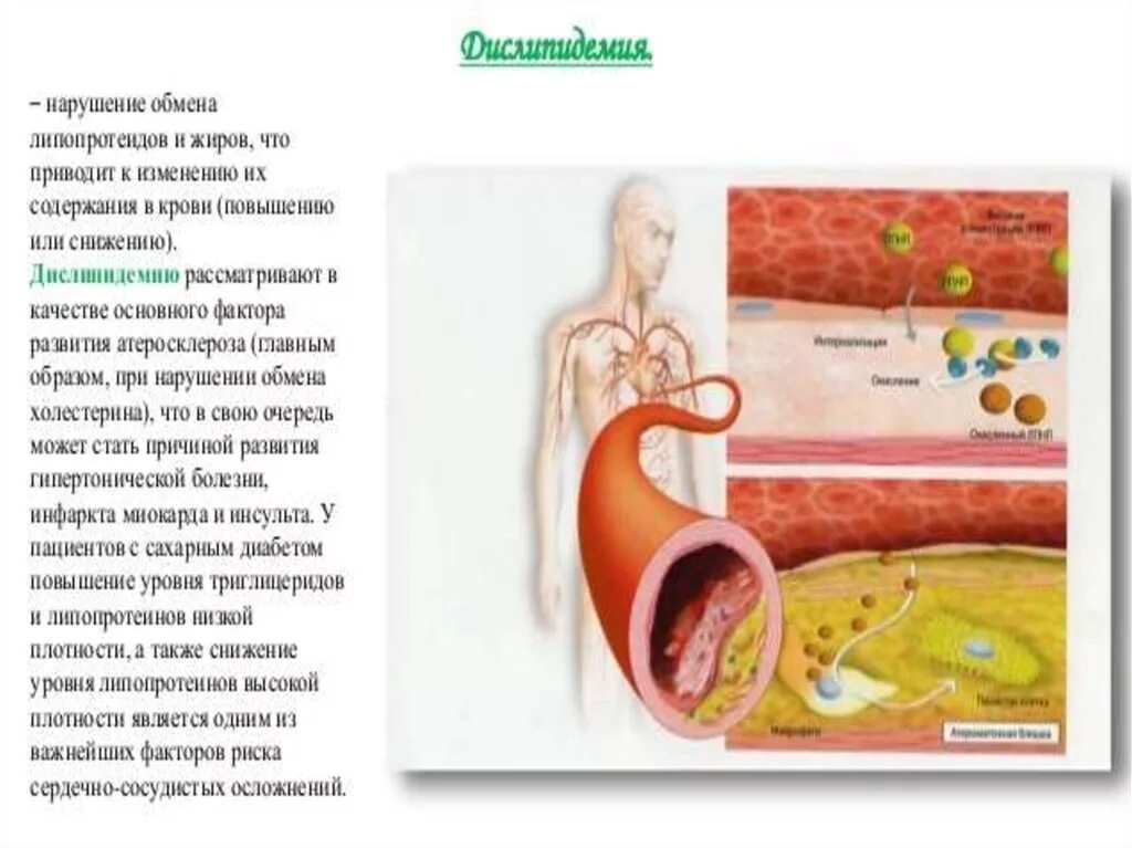 При атеросклерозе ограничивают продукты питания содержащие