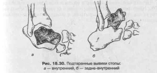 Глава 18