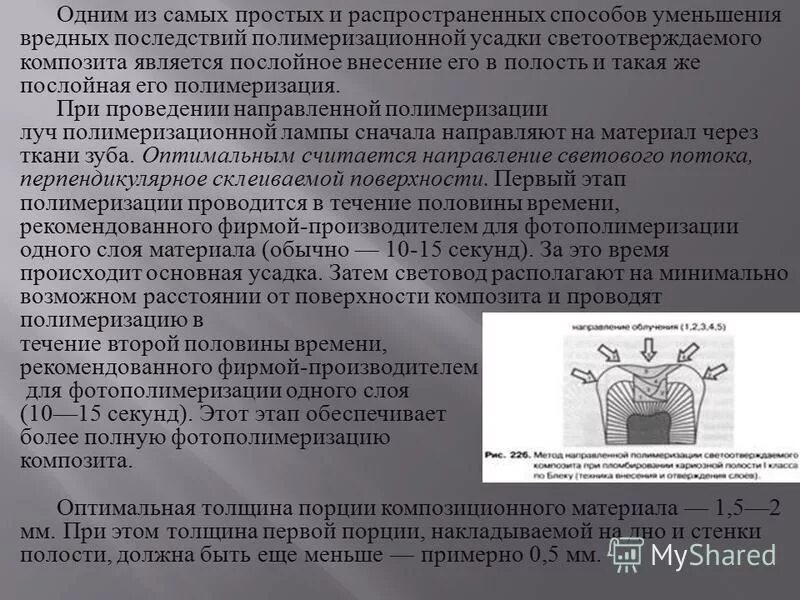 усадка химических композитов