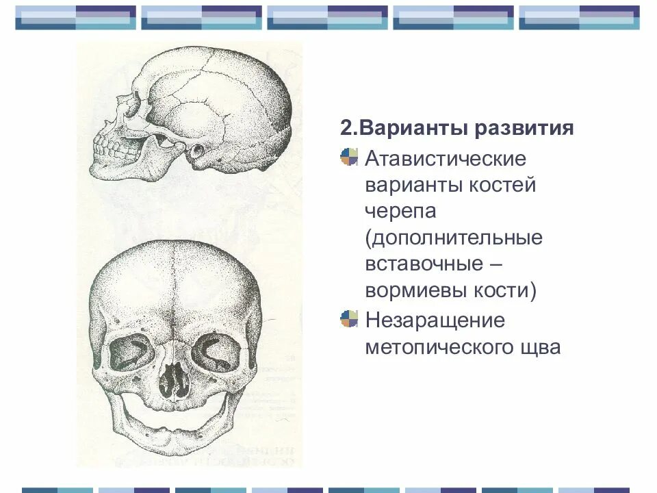 Черепная аномалия. Аномалии развития костей черепа анатомия. Вормиевы кости черепа аномалия. Пороки развития костей черепа. Вставочные кости черепа.