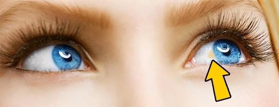 Почему глаза желтые причина. Здоровые глаза. Сине желтые глаза.