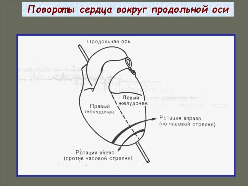 Определение поворотов сердца вокруг продольной оси. Поворот сердца вокруг продольной оси против часовой стрелки на ЭКГ. Повороты сердца на ЭКГ вокруг продольной оси. Поворот сердца вокруг продольной оси по часовой стрелке. Поворот правым желудочком вперед