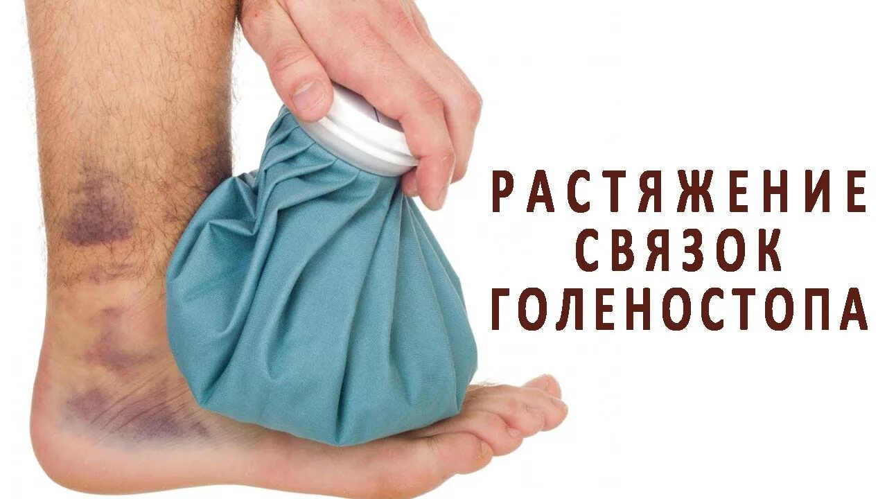 Что помогает при растяжении связок. Растяжение связок голеностопа.