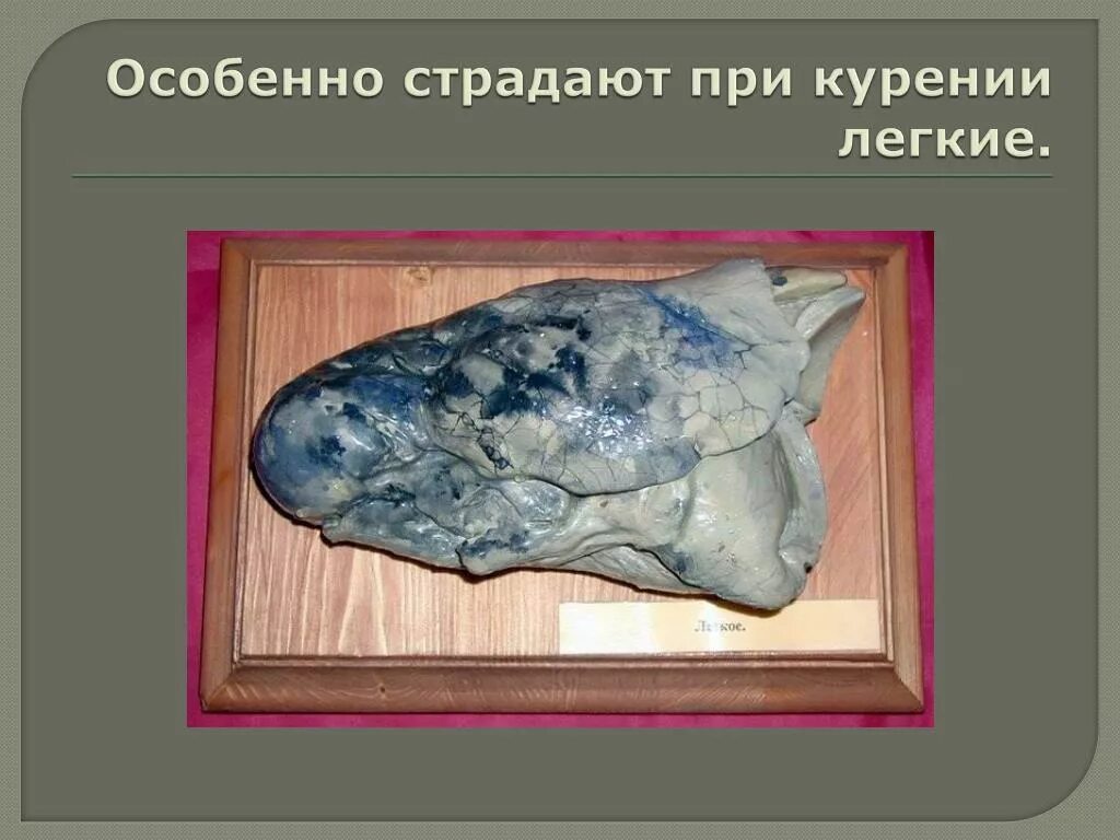 Борьба с белой чумой: понимание, профилактика и лечение туберкулеза Мир в одном 