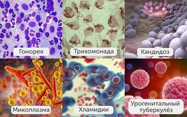 Chlamydia trachomatis neisseria gonorrhoeae. Хламидии гонорея возбудитель. Возбудители венерологических заболеваний. Венерические заболевания бактерии. Венерическое инфекционное заболевание.