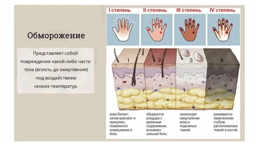 Травмы кожи 8 класс биология. Болезни и травмы кожи кратко. Болезни и травмы кожи травмы кожи. Рисунок по болезни и травмы кожи. Заболевания и повреждения кожи