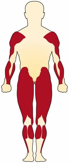 Muscle diseases. Muscle diseases. Перенапряжение мышц. Muscle diseases. Muscular dystrophy association.