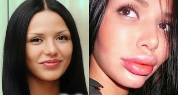Почему девушки делают губы. Светлана давыдова дом 2 после пластики. светлана давыдова 2025. светлана давыдова дом 2 губы. светлана давыдова губы.