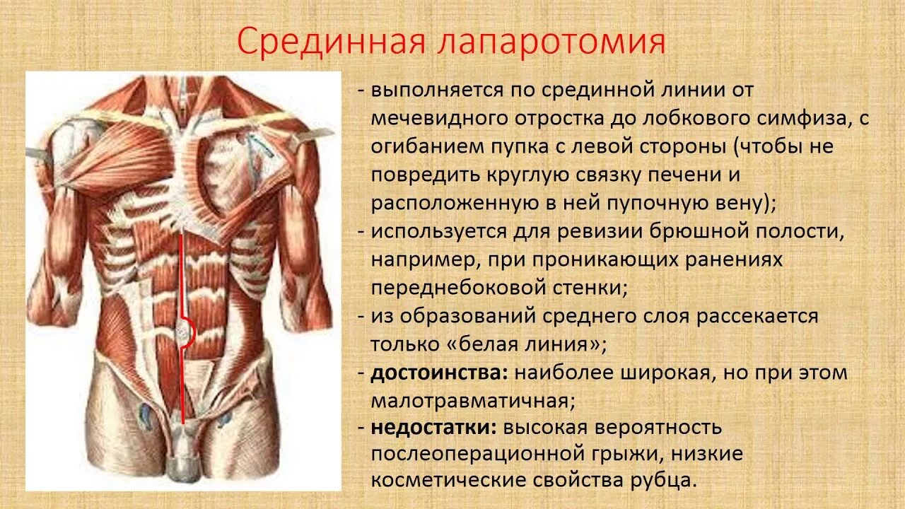 Лапаротомия что это такое простыми словами. Средняя срединная лапаротомия. Верхняя срединная лапаротомия. Срединно срединная лапаротомия.