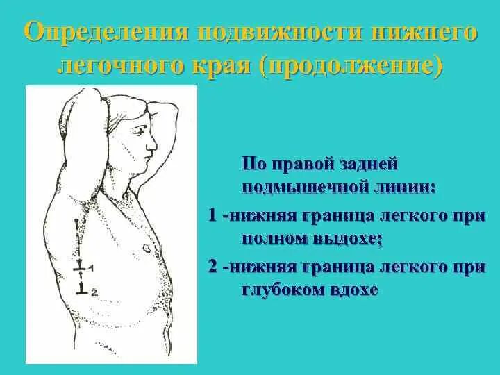 Границы легких сбоку. Нижние границы левого легкого в норме. Передняя средняя и задняя подмышечные линии. Нижняя граница легких по средней подмышечной линии. Границы легких при перкуссии в норме.