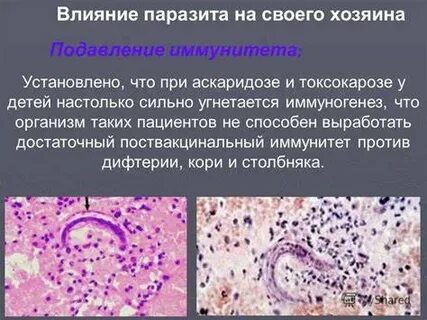Диета при аскаридозе