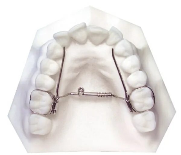 Аппарат хасса. Аппарат Spring Jet. Spring Jet аппарат ортодонтия. Аппарат Дерихсвайлера ортодонтия. Аппарат для расширения небного шва.