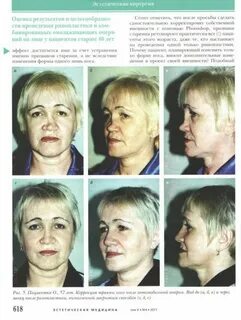 Пластическая владивосток
