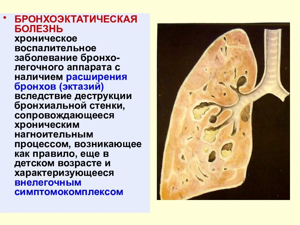 Бронхит бронхоэктатическая болезнь. Бронхоэктатическая эмфизема. Деструктивный мешотчатый бронхоэктаз. Бронхоэктатической болезнью макропрепарат. Мешотчатые бронхоэктазы.