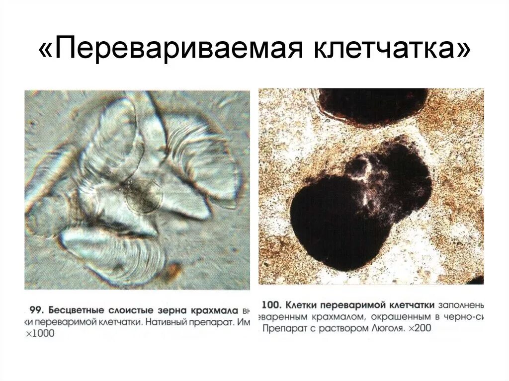 Микроскопия кала растительная клетчатка переваримая. Копрограмма растительная клетчатка неперевариваемая. Растительная клетчатка копрология. Копрограмма микроскопия клетчатка переваренная. Перевариваемая растительная клетчатка в кале у ребенка