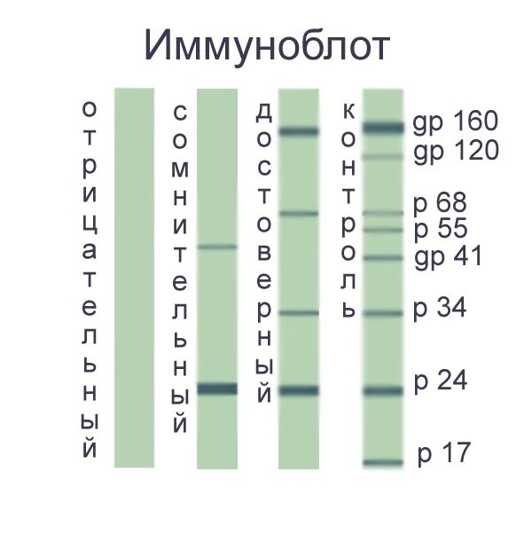 И иммуноблот и ифа положительный. Положительный иммуноблот на вич. Иммуноблот анализ. Иммуноблот антинуклеарных антител расшифровка. Иммуноблот системная красная волчанка.