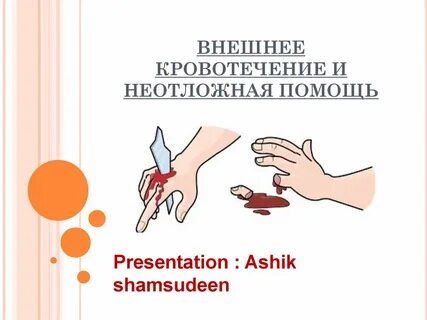 Наружное кровотечение бывает