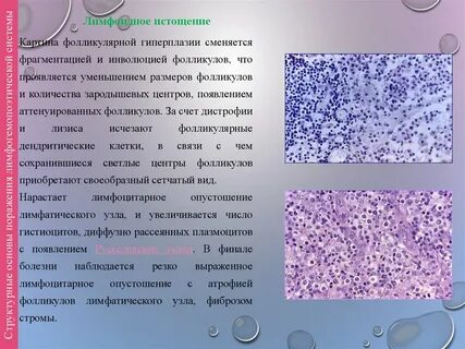Гиперплазия лимфоидной ткани