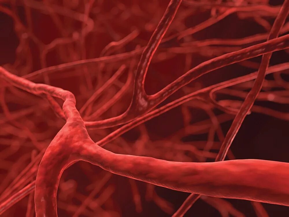 Васкулит микрососудистого русла. Кровеносная система капилляры. Узелковый полиартериит.