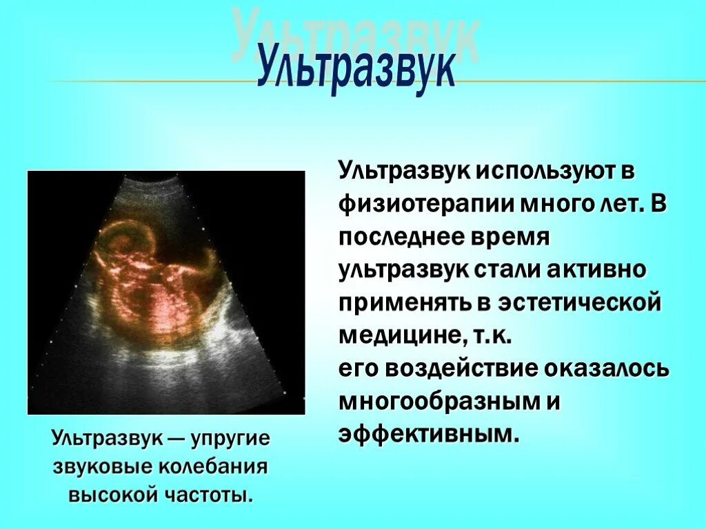 Ультразвук как проходит. Ультразвук. ультразвук презентация. ультразвук картинки. презентация на тему ультразвук.