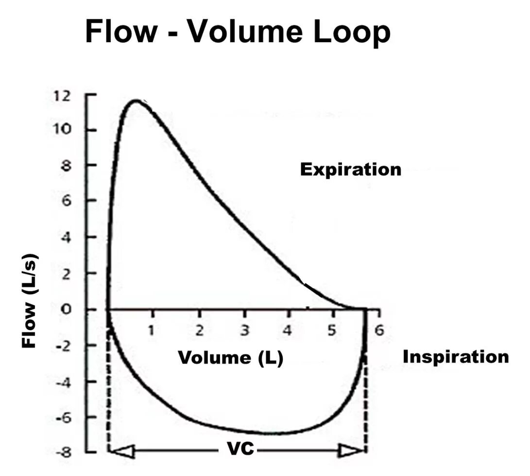 Flow loop. Flow volume loop. flow volume расшифровка. pulmonary function testing. spirometry restrictiv disease result.