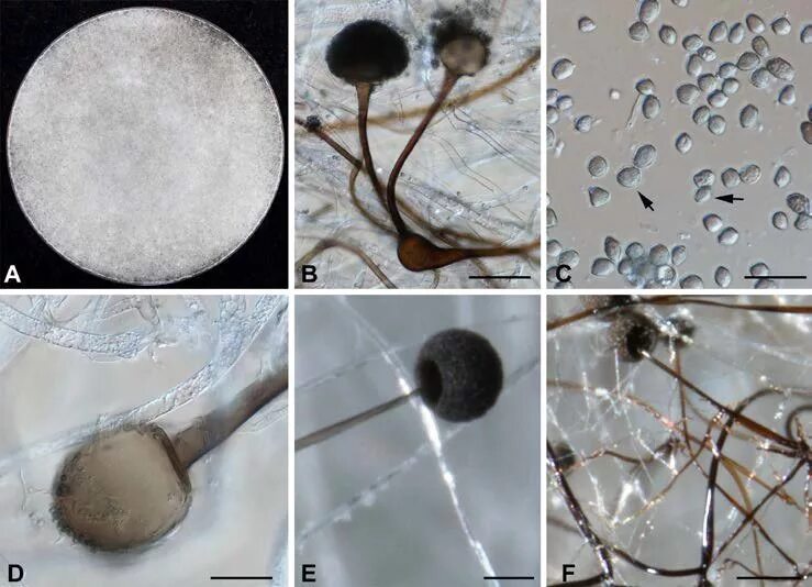 Споры гриба мукора. Мукор ризопус. Плесневые грибы Rhizopus. Плесень мукор и пеницилл. Плесневые грибы мукор.