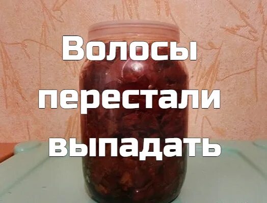 Много новых волос выросло. Перестали выпадать. Трансплантация волос женская. Перестали выпадать. Перестали выпадать.