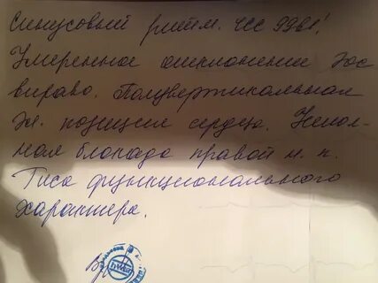 Заключение врача миокарда