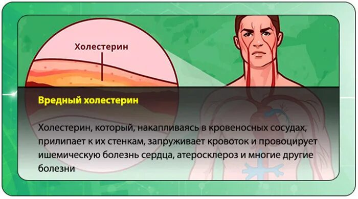 Холестерин вред и польза. Вредный холестерин. Полезный холестерин. Холестерин вреден или полезен. Холестерин это вредно.