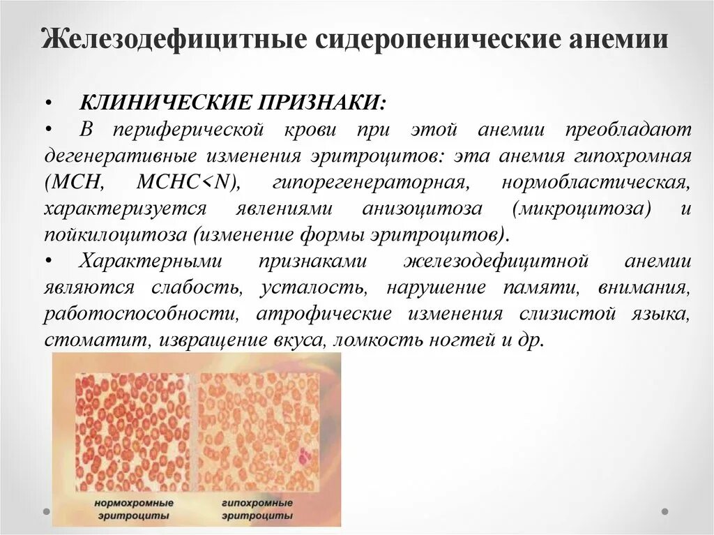 Кожные покровы при железодефицитной. Изменения при железодефицитной анемии. клинические проявления при железодефицитной анемии. изменения крови при железодефицитной анемии. изменения периферической крови при железодефицитной анемии.