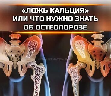 Пороз