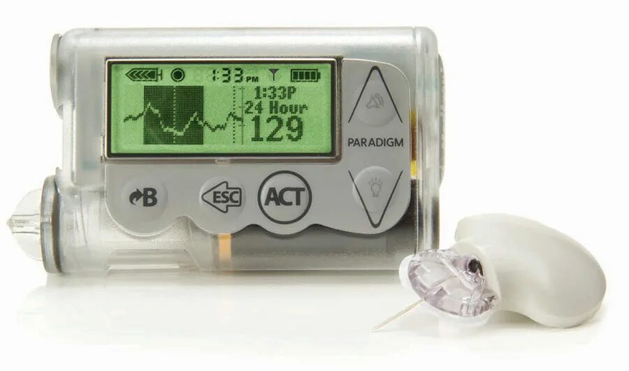 Medtronic minimed. Помпа инсулиновая minimed paradigm real time mmt-722. помпа медтроник 722. помпа medtronic 754. инсулиновая помпа paradigm real-time mmt-722/522 (medtronic, сша).