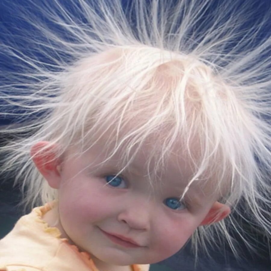 Волосы сильно электризуются. Электризация волос. Статическое электричество волосы. Наэлектризованные волосы. Волосы дыбом.