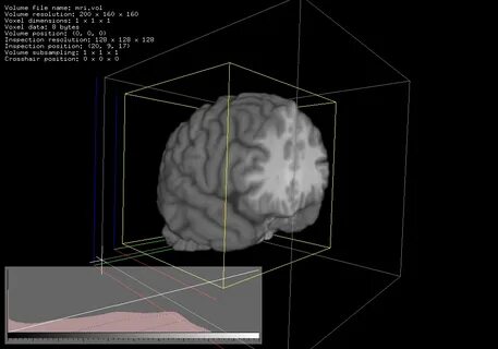 Volume rendering
