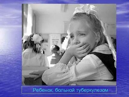Дети больные туберкулезом