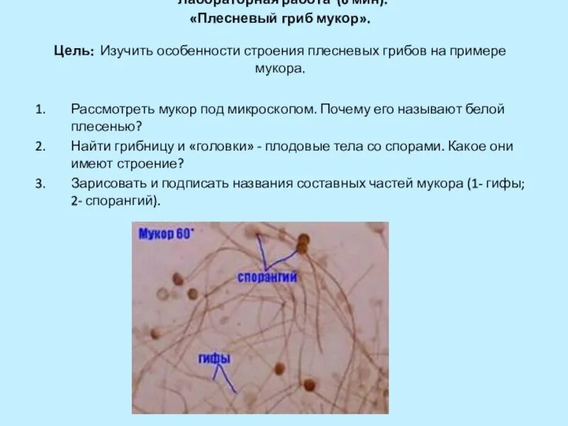 Плесневый гриб мукор относится к. Гриб мукор строение под микроскопом. Строение гриба мукора. Строение плесневого гриба мукора. Плесневый гриб мукор.