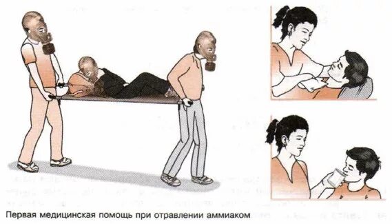 Помощь при отравлении аммиаком. Первая врачебная помощь при отравлении аммиаком. 1 медицинская помощь при отравлении аммиаком. порядок первой помощи при отравлении аммиаком. первая помощь при удушье аммиаком.