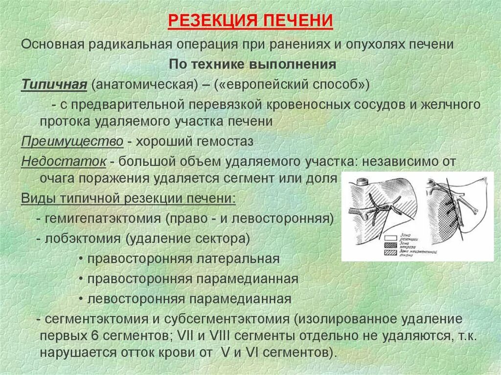 Типичная и атипичная резекция печени. Удаление опухолей печени