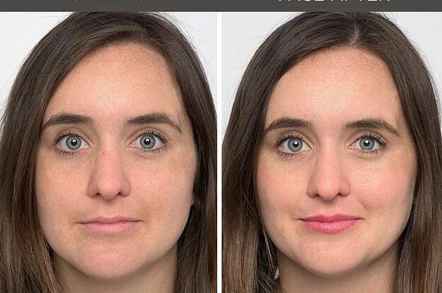 Face comparison. Face before and after. фулл фейс до после. mattifying face before after. фул фейс лифт фото до и после.