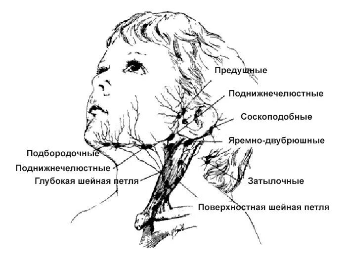 Расположение лимфоузлов на шее спереди схема. Лимфоузлы у детей расположение. Схема расположения лимфатических узлов на шее. Схема расположения лимфоузлов у детей. Прощупывается лимфоузел на шее