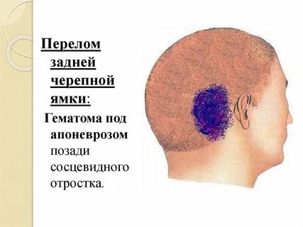 Как лечить черепной