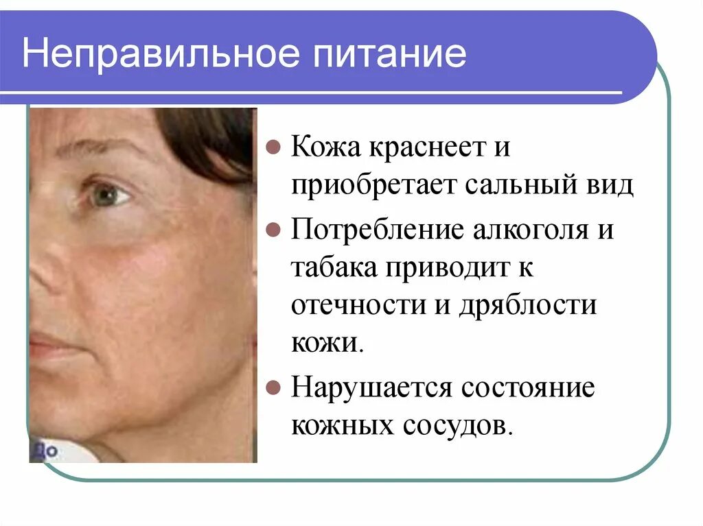 Последствия неправильного. Последствия неправильного питания. Заболевания из за неправильного питания. Питание кожи. Неправильное питание и кожа.